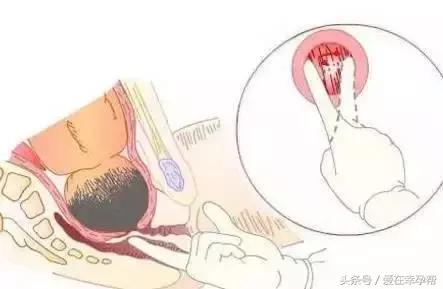 做内检遇到男医生,内检遇到男大夫应该怎么办