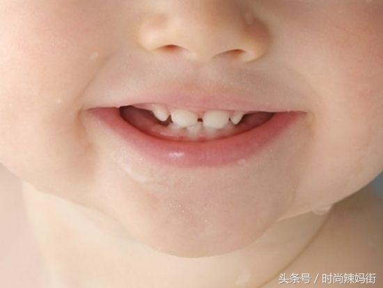 宝宝出牙期的不适感怎么缓解,怎样缓解出牙不适