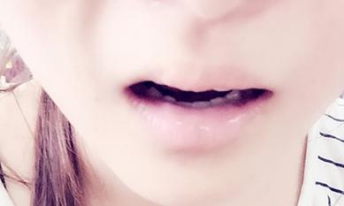 再障怎么理解,再障三种学说