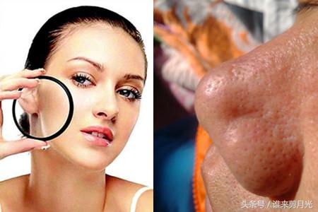 脸颊毛孔有黑头还能恢复细腻吗,毛孔粗大有黑头怎么解决小妙招