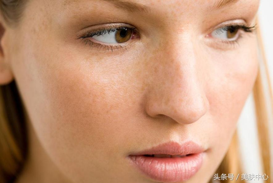 不用花钱怎么才能去掉脸上的斑点,不用花钱去掉斑