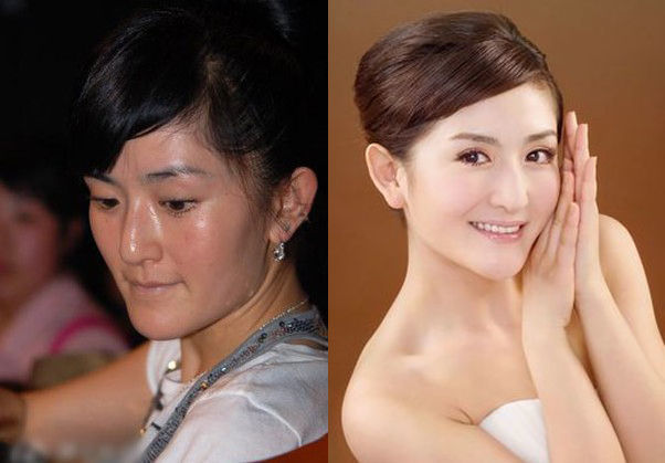 俄罗斯专家注射细菌抗衰老,抗衰老的细菌