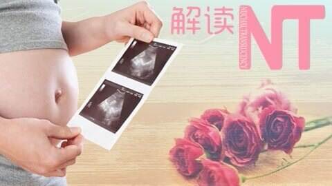 怀孕检查nt有必要做吗,孕妇nt检查有必要吗