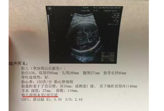 产科医生教你如何看懂B超单建议孕妈收藏