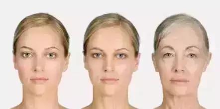 牙齿矫正出现黑三角,儿童牙齿矫正会出现黑三角吗