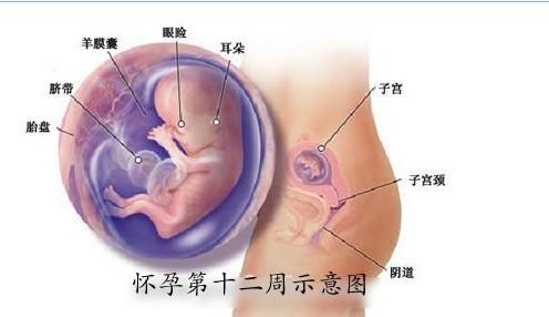 孕12周胎停孕妇会有什么症状,怀孕第十二周注意事项