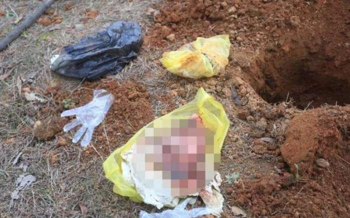 无痛人流一点血都不出,无痛人流后什么时候恢复到正常