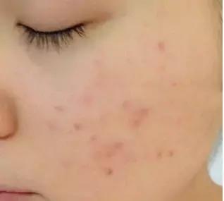 澳洲十大有机护肤品,澳洲有机认证护肤品牌