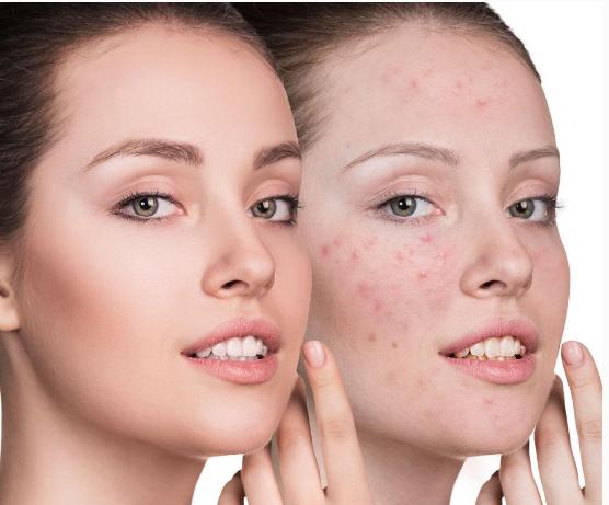 6大症状代表已经到了更年期,月经伴有这三种情况一定要看医生