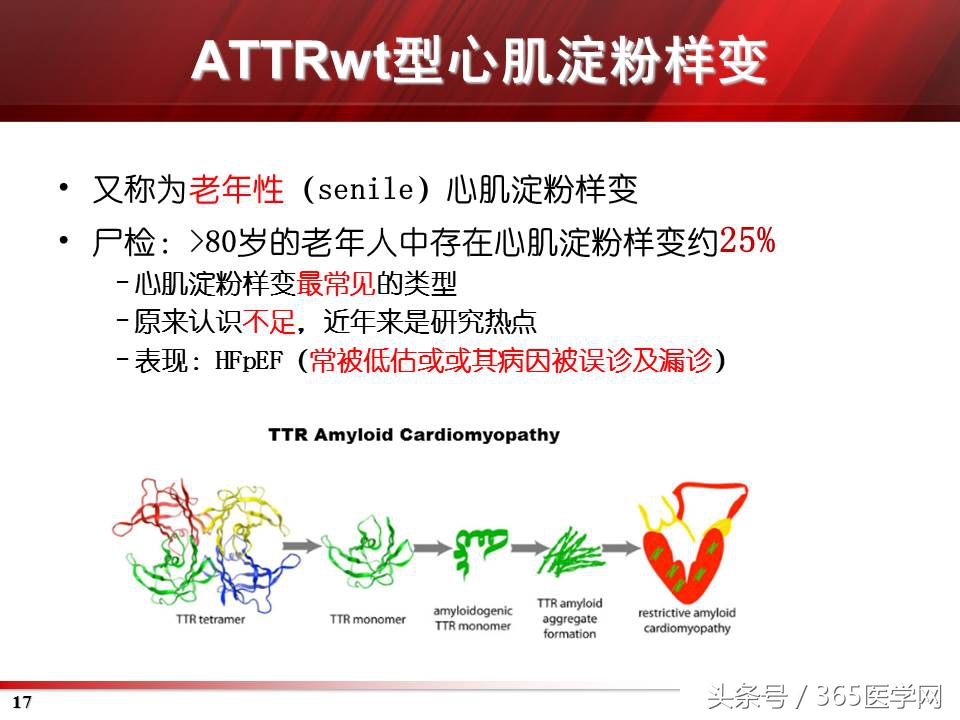 心力衰竭心房颤动,心衰时心肌酶的变化