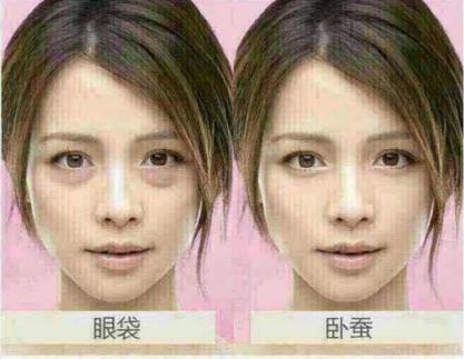 赵丽颖脸前后对比照片,赵丽颖整眼睛前后对比照片