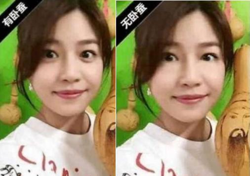 赵丽颖脸前后对比照片,赵丽颖整眼睛前后对比照片