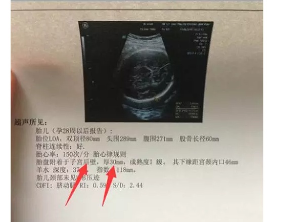 产科医生教你如何看懂B超单建议孕妈收藏