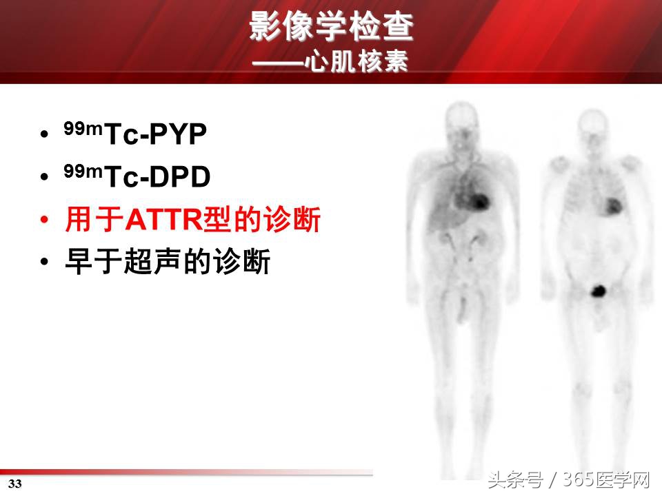心力衰竭心房颤动,心衰时心肌酶的变化