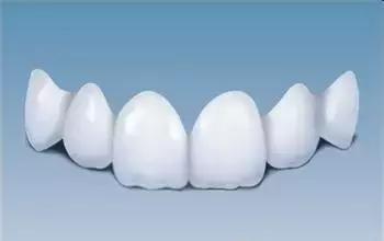 牙齿矫正出现黑三角,儿童牙齿矫正会出现黑三角吗