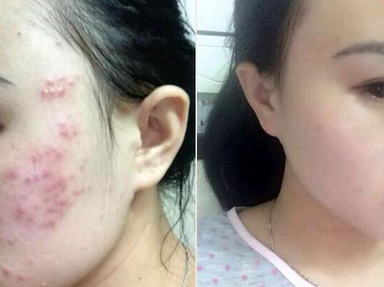 有没有不对皮肤造成负担的彩妆,哪个牌子的彩妆对脸没有伤害