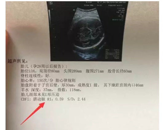 产科医生教你如何看懂B超单建议孕妈收藏