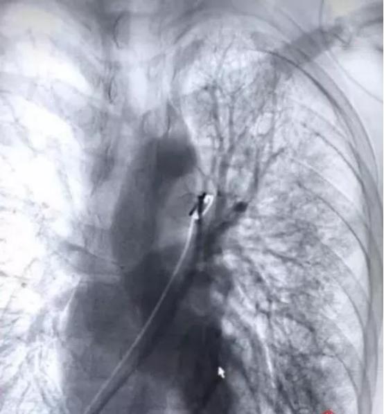 男子计划十一陪父母尽孝心结果熬夜加班累吐血