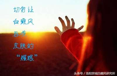 长白癜风不要慌医生教你正确处理,为什么现在长白癜风的越来越多