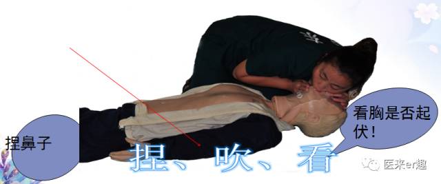 一岁以上cpr急救法演示,儿子cpr抢救