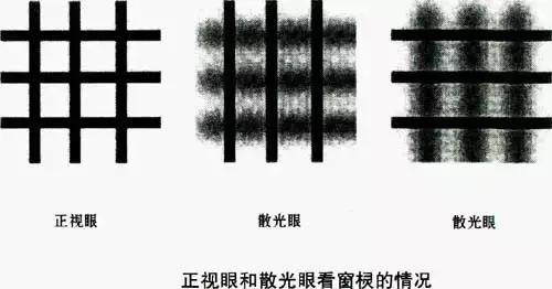 散光75度怎么样缓解,关于镜片你不得不知道的几点知识