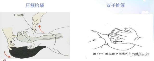 一岁以上cpr急救法演示,儿子cpr抢救