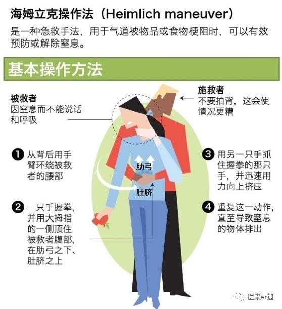 一岁以上cpr急救法演示,儿子cpr抢救