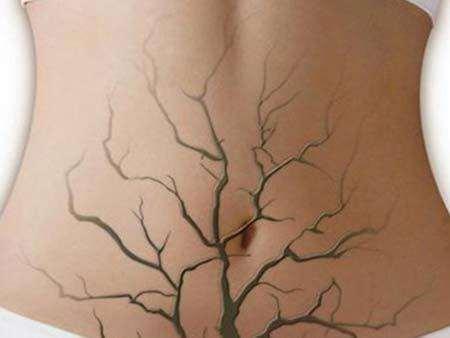 原来“pa”一下就可以解决便秘