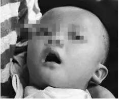 儿童癫痫难治吗？这位母亲已带孩子笑着出院，走在了康复的路