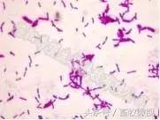 凝结芽孢杆菌作用机理及功能特点