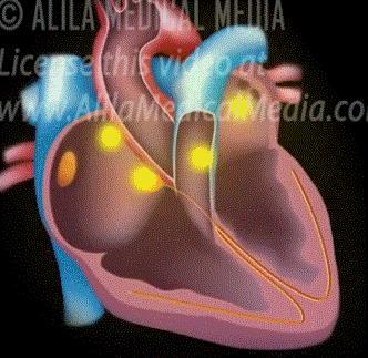 做房颤射频消融手术前的注意事项,房颤射频消融术后如何康复