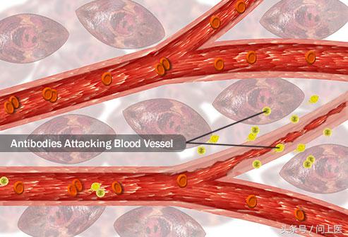 尿液还有哪些常见的危害,尿液有问题一般会有哪些疾病