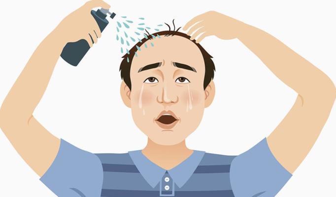 脂溢性脱发m型发际线还能恢复吗,脂溢性脱发发际线能长回来吗