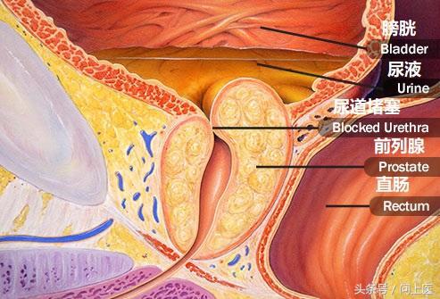 尿液还有哪些常见的危害,尿液有问题一般会有哪些疾病