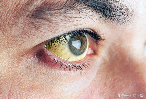 尿液还有哪些常见的危害,尿液有问题一般会有哪些疾病