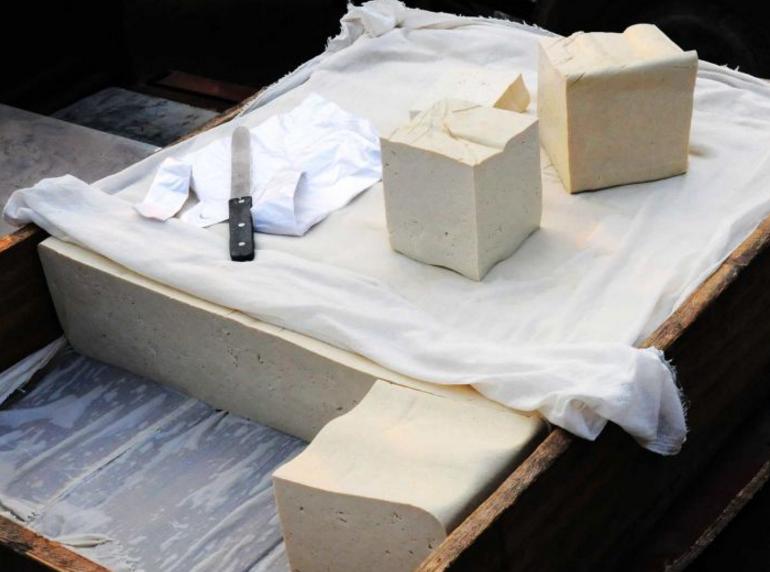 便秘折磨15年,吃不下,拉不出!原来肚里长个10斤大“皮球”