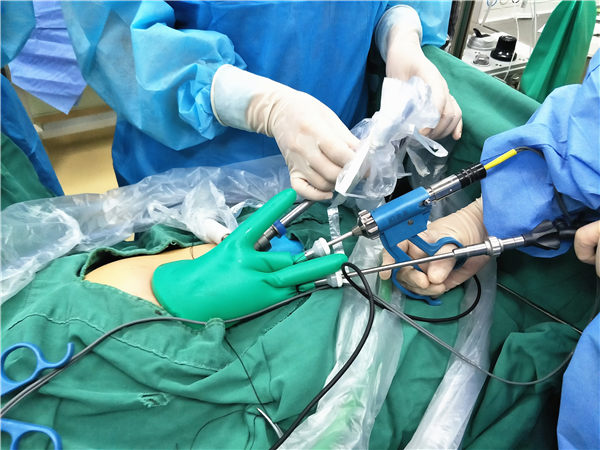 淄博妇幼宫腹腔镜,淄博市妇幼保健院腹腔镜手术