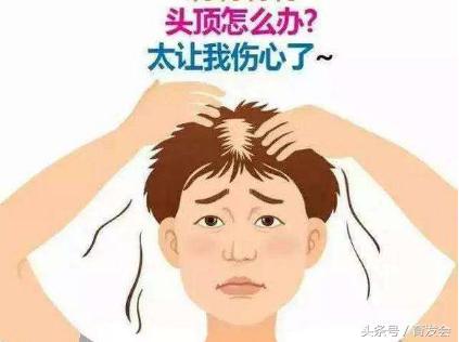 植发能不能解决脱发问题,植发能不能彻底解决脱发