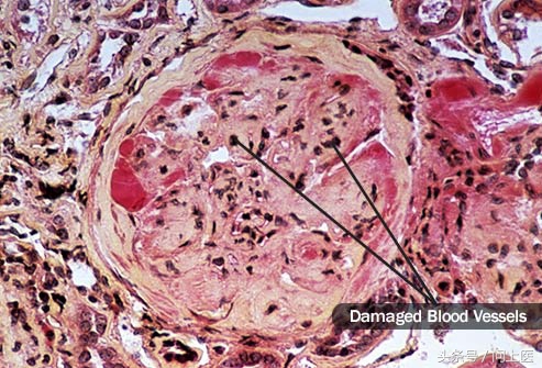 尿液还有哪些常见的危害,尿液有问题一般会有哪些疾病