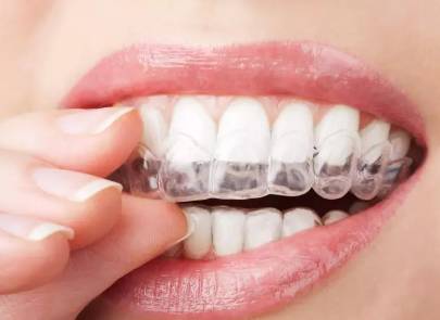 网上买透明牙套矫正牙齿靠谱吗,小孩矫正牙齿用哪种牙套比较好