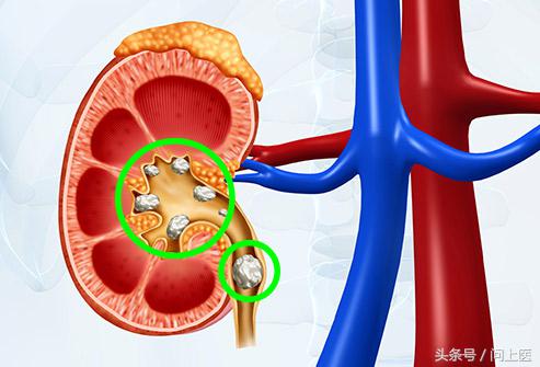 尿液还有哪些常见的危害,尿液有问题一般会有哪些疾病