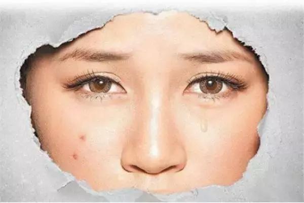 祛痘痘的正确护肤方法,长痘祛痘用什么方法最有效