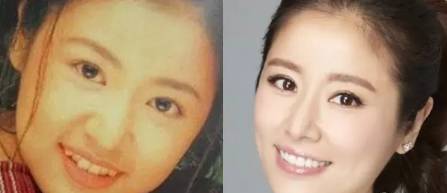 网上买透明牙套矫正牙齿靠谱吗,小孩矫正牙齿用哪种牙套比较好