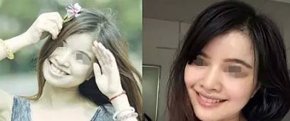 网上买透明牙套矫正牙齿靠谱吗,小孩矫正牙齿用哪种牙套比较好