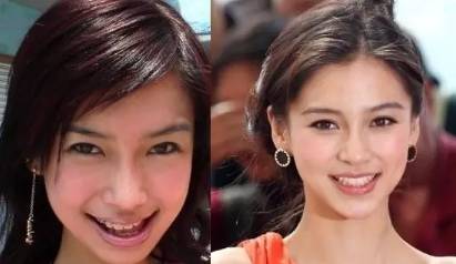 网上买透明牙套矫正牙齿靠谱吗,小孩矫正牙齿用哪种牙套比较好