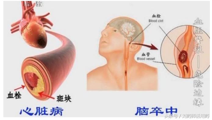 2型糖尿病空腹血糖高的原因,2型糖尿病空腹血糖6-7危害大吗
