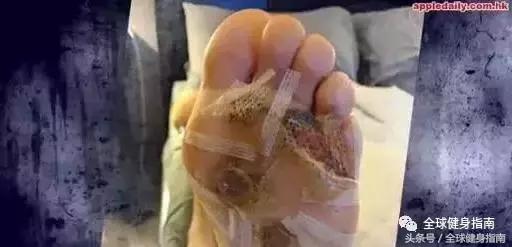 健身房哑铃比马桶脏362倍,光脚洗澡会溃烂?你的健身房还好吗?