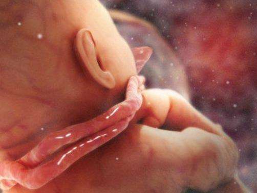 怎么解决脐带绕颈,解决脐带绕颈有方法