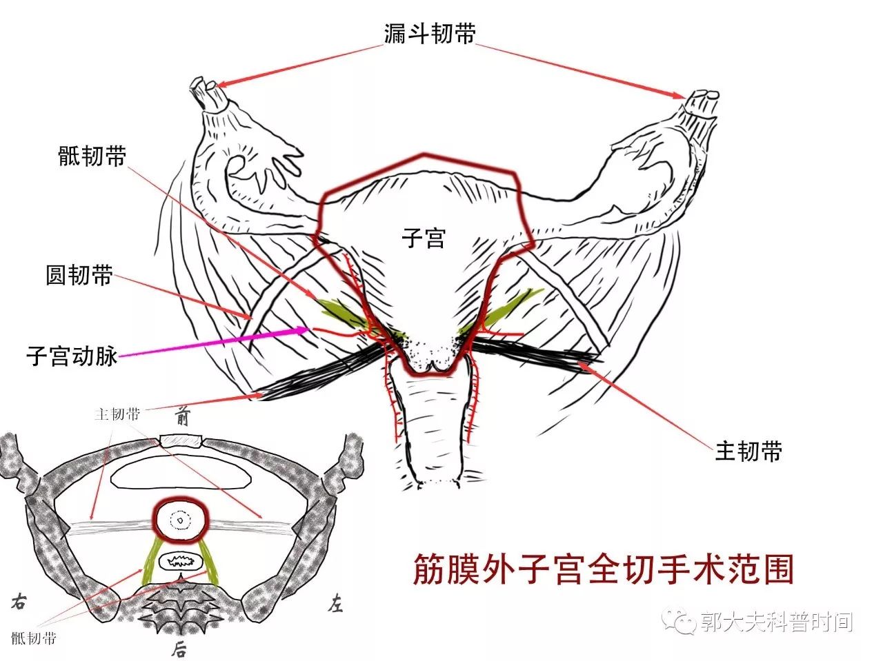 关于子宫切除的小秘密（一）——切除范围