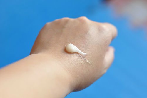 宝宝湿疹全效修复膏,宝宝湿疹用药王草本抑菌膏